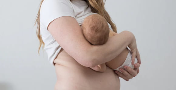 diastasis recti safe recovery