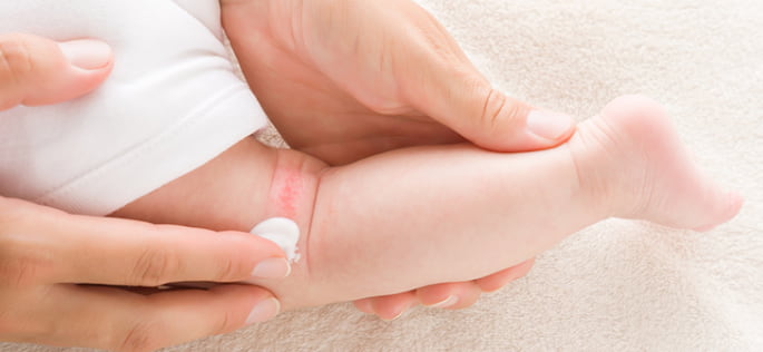 Lukewarm Bath For Eczema