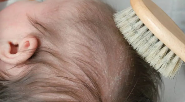 Safe Natural Baby Skincare